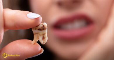 Are Cavities Contagious