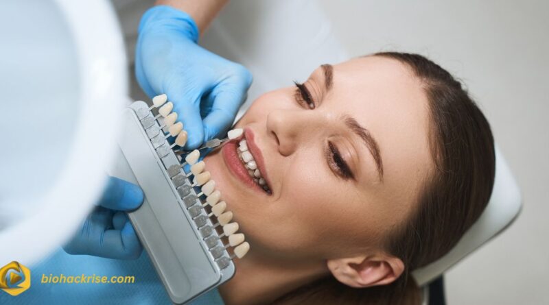 Teeth Before Veneers