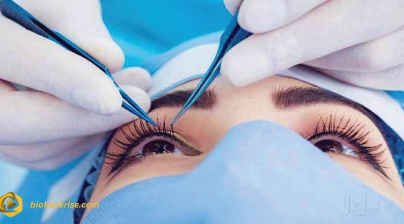 Is LASIK Worth It in 2025? A Complete Guide to Costs, Benefits, and Risks